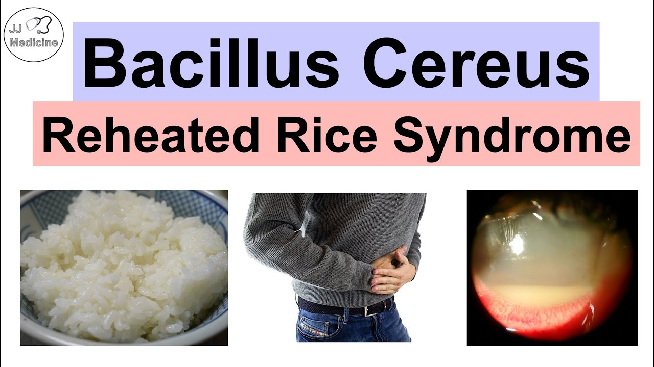 Bacillus Cereus (Reheated Rice Syndrome) Food Poisoning, Pathology ...