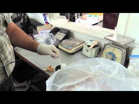 Getting A Gold Tooth | xoVain Getting A Gold Tooth | xoVain
