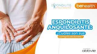 Complicaciones de la ESPONDILITIS ANQUILOSANTE