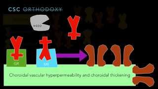 Central Serous Chorioretinopathy Part 3