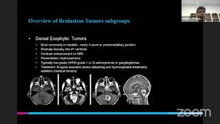 Pediatric Brainstem Tumors with Abhiraj Bhimani, MD