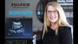 Fujifilm Sonosite Australasia Introduces Sonosite PX