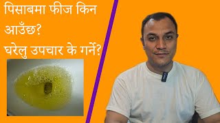 पिसाबमा फीज किन आउँछ। घरेलु उपचार कसरी गर्ने? Frothy urine / home remedy - Dr. Diwakar Manandhar