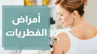 أمراض الفطريات وأسبابها وطرق علاجها