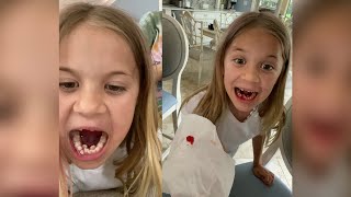 Rory gets her tooth pulled out!! #shorts #funny #smellybellytv