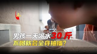 14歲男孩一天喝30斤水，不喝居然會全身抽搐，醫生竟也束手無策？