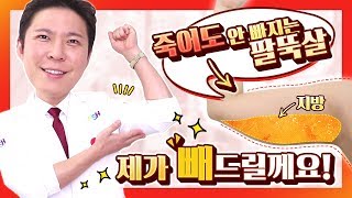 팔뚝지방흡입 팔뚝살 빼는 법 (SUB)지방수술 전문의사가 푸는 팔지방흡입의 모든것후기 효과 디자인 부작용 수술방법(All of arm liposuction)