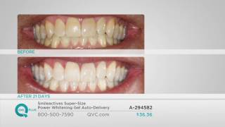 Smileactives Super-Size Power Whitening Gel Auto-Delivery on QVC