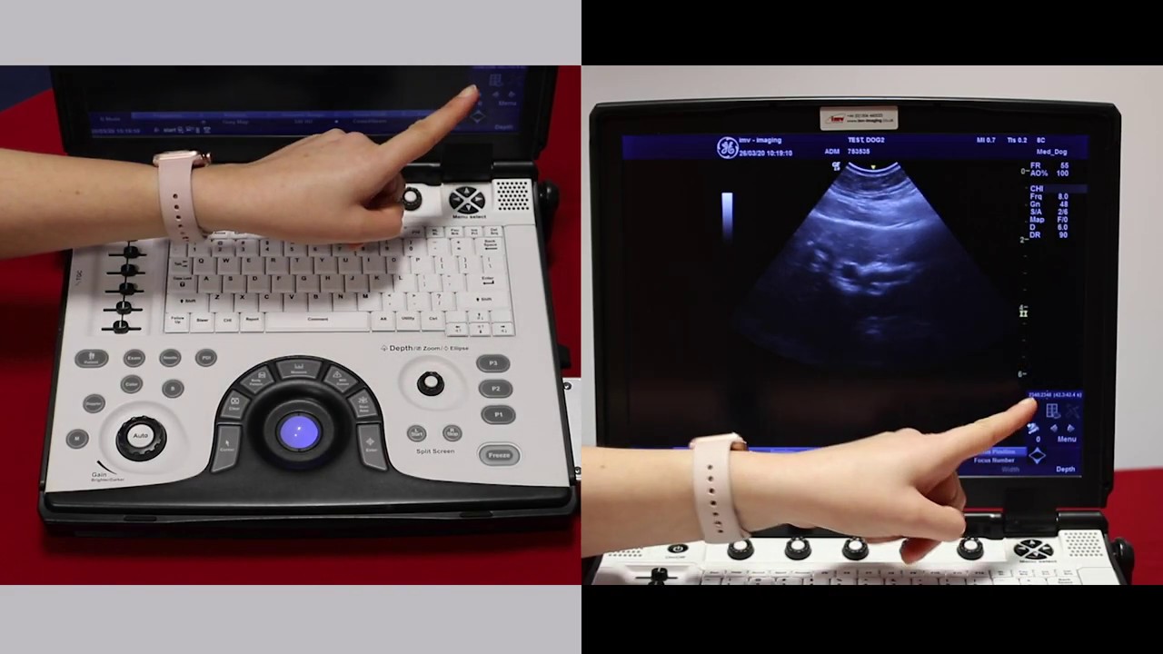 How To Use Basic B Mode Settings On The GE Logiq E Ultrasound Scanner ...