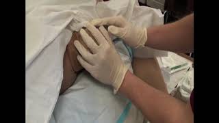 Childbirth - Normal Delivery