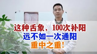 这种舌象，100次补阳，远不如一次通阳，重中之重！