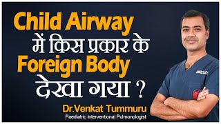 Hi9 | Child Airway में  किस प्रकार के Foreign Body देखा गया | Dr. Venkat Tummuru, Pulmonologist