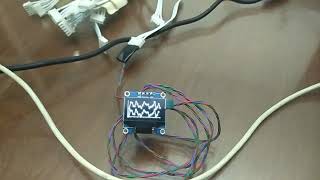 Drawing charts in OLED displays
