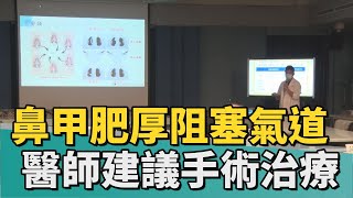 健康 醫療｜鼻塞.鼻甲肥厚阻塞氣道 醫師建議手術治療