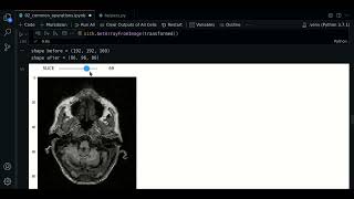 2.1 - Shrink | SimpleITK - Course MRI preprocessing with Python