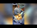 breast augmentation full surgery 370cc gummy bear implants seattle bellevue kirkland