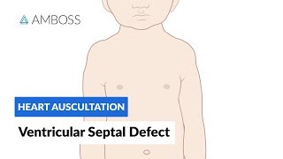 Ventricular Septal Defect (VSD) - Heart Auscultation - Episode 11