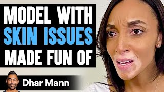 MODEL With SKIN ISSUES Made Fun Of, What Happens Is Shocking | Dhar Mann