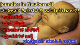 ನವಜಾತ ಶಿಶುಗಳಲ್ಲಿ ಕಾಮಾಲೆ ರೋಗ!! Jaundice in newborns