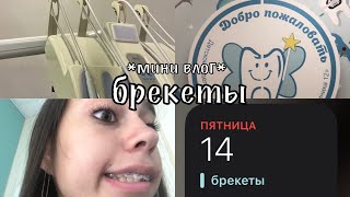 мне ставят брекеты... / mini vlog