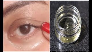 Use this 1 Powerful Trick /Therapy to Remove Dark Circles Permanently
