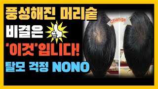 실제로 효과가 있는 탈모 음식 9가지! 이제 자신감을 되찾으세요!