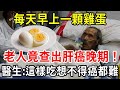 With an egg every morning  the old man was found to have advanced liver cancer! Doctor: It's hard t