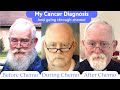 Cancer Patient Story: My 1st Symptoms, Tests & Diagnosis (Blood Cancer) | Bill (1 of 4)