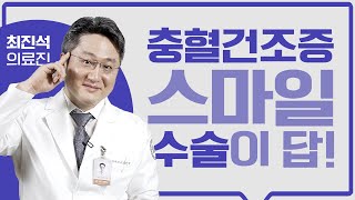 고도근시·난시도 가능한 스마일수술, 스마일수술은 무엇일까요?