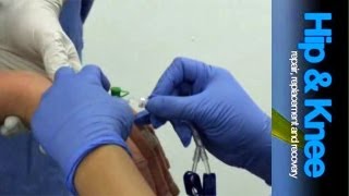 Total Knee Replacement: Anaesthetic Options