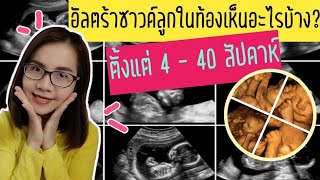 อัลตร้าซาวน์ลูกในท้องเห็นอะไรบ้าง? ตั้งแต่ 4 - 40 สัปดาห์