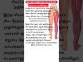 சியாட்டிகா என்னும் ஒரு பக்க கால் வலி எதனால் ஏற்படுகிறது.. sciatica healthtips shorts unknownfacts