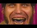 Why Andre The Giant NEVER brushes his Yellow Teeth?