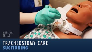 Nursing Skills: Tracheostomy Suctioning