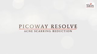 Picoway Resolve | Acne Scarring Reduction