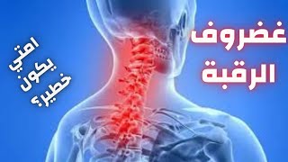 الانزلاق الغضروفي العنقي:امتي يكون خطير/علامات الخطر في الانزلاق الغضروفي العنقي/غضروف الرقبة