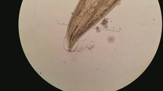 Pinworm (Enterobius vermicularis) 100x, 400x magnification