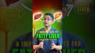Fatty Liver The 4 Tests You Need