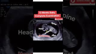 13 weeks pregnancy baby growth🥰🥰🥰|#viral #trending