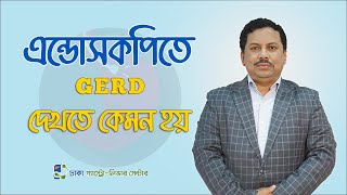 এন্ডোসকপিতে GERD দেখতে কেমন - ডাঃ এম. সাঈদুল হক