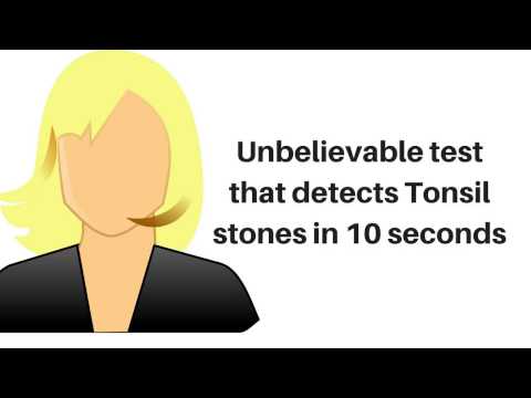 unbelievable test that detects hidden tonsil stones in 10 seconds unbelievable test that detects hidden tonsil stones in 10 seconds