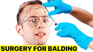 I Got Surgery For My Balding | Surgeon Reacts