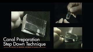 Canal Preparation Step Down Technique