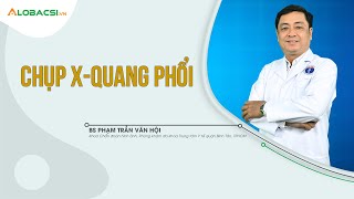 Chụp X-quang phổi phát hiện những bệnh gì? |  Chụp X-quang có ảnh hưởng gì tới sức khỏe?