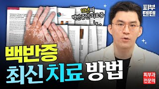 백반증 환자가 알아야하는 모든 지식: 엑시머 팔라스 피부이식 SST 세포치료 MBEH 탈색치료 먹는약 바르는약