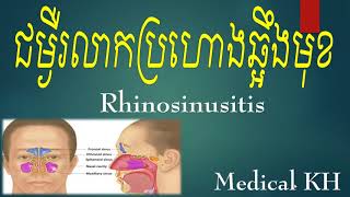 Rhinosinusitis_ជម្ងឺរលាកប្រហោងឆ្អឹងមុខ