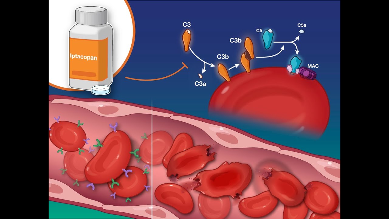 Iptacopan For Paroxysmal Nocturnal Hemoglobinuria | NEJM - YouTube