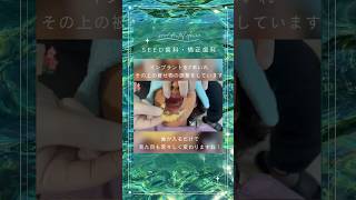 インプラントをいれおわり、上の被せ物を作っている途中です🩷🩷完成までもう少し！！#審美歯科#シード歯科# #歯科医師 #マウスピース矯正 #アライナー矯正 #インプラント