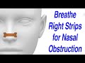 Breathe Right Nasal Strips to Resolve Nasal Obstruction