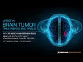 Latest in Brain Tumor Treatments and Trials